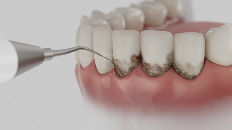 Trusted Teeth Cleaning And Checkup service in Geronimo, OK - Dentist Open Now